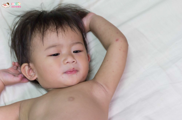 Biến chứng của bệnh tay chân miệng